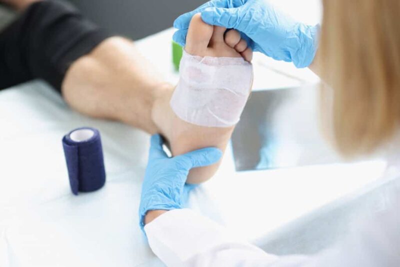 Bandaged foot being examined by a podiatrist after plantar wart treatment